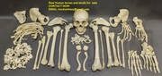 Real human skulls,  human skeletons,  and individual human bones for sal